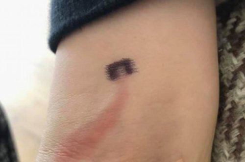 Мать заметила ссадину на руке сына и спасла ему жизнь