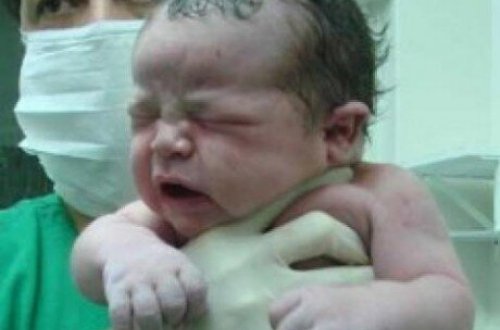 Azərbaycanda sağ tərəfdə orqanları olmayan uşaq dünyaya gəlib - FOTOLAR