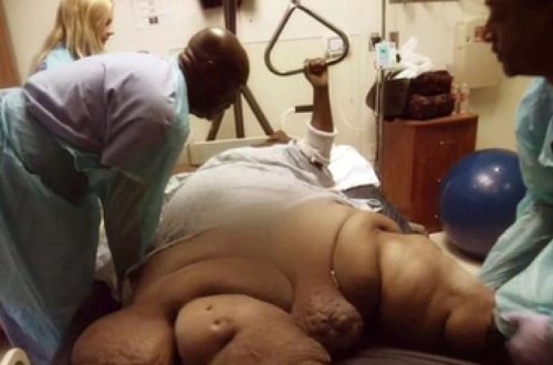 Женщина сбросила 200 килограммов и впервые за долгие годы встала с дивана