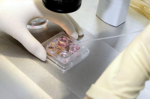 Narkomanlar arasında QİÇS-ə tutulmuş insanlar var? - Səhiyyə Nazirliyi açıqladı?