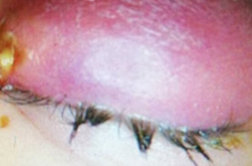 28 yaşlı qadının gözündən çıxanlar ŞOK ETDİ - FOTOLAR