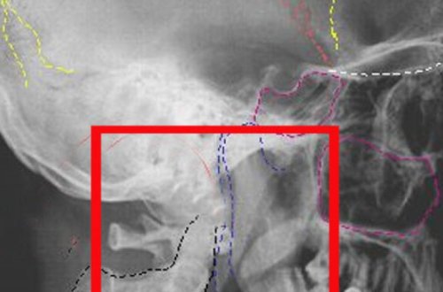 Жительница Петербурга проломила череп мужу во время скандала