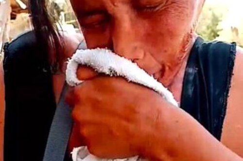 Görülməmiş hadisə! 15 ildir bu vəziyyətdə yaşayır - FOTOLAR