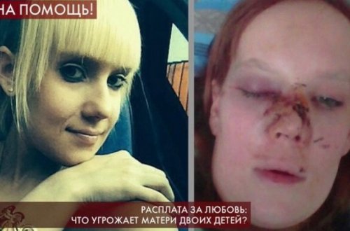 Скончалась избитая мужем участница российского шоу «Пусть говорят»