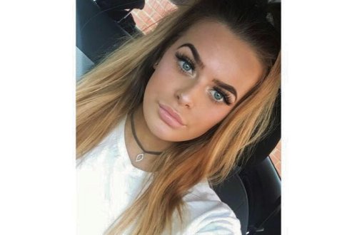 Ağzında yaralar çıxdı, dəhşətli diaqnoz qoyuldu - Ağıziçi xoraların qorxulu səbəbi