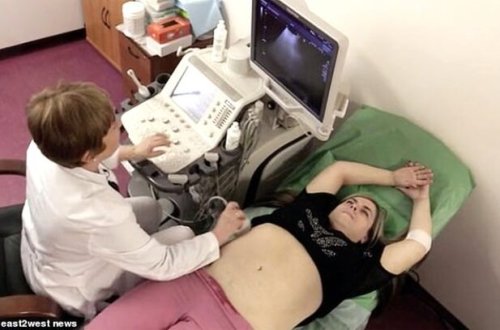 33 yaşlı qadının hamiləlikdən sonra başına gələnlər hər kəsi ŞOK ETDİ - FOTOLAR