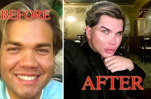 Oyuncağa bənzəmək üçün 70 dəfə əməliyyat olunan oğlanın son halı DƏHŞƏTƏ GƏTİRDİ - FOTOLAR