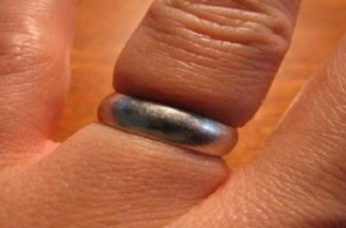 Bakıda barmağında dəmir halqa qalan şəxsin köməyinə FHN gəldi