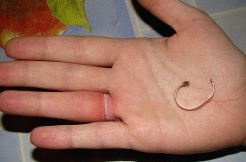 Спасатели в Баку помогли снять железное кольцо с пальца