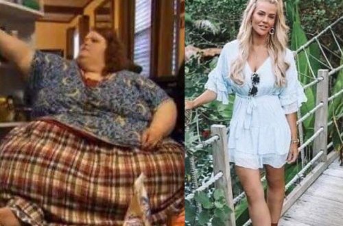 Bu qadın 206 kq arıqlayaraq, belə oldu - FOTO