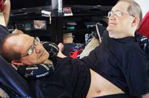 Dünyanın ən qoca Siam əkizlərindən biri ölsə, digərini öldürməli olacaqlar - FOTO