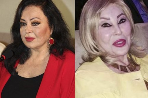 Türkan Şorayla Amaliya Pənahovanın plastik əliyyatdan əvvəlki fotoları görənləri heyrətə saldı-FOTOLAR