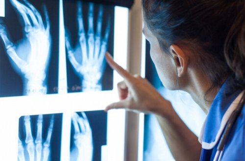 Rentgen və tomoqrafiya xərçəngin riskini artırır - Diqqətli olun!