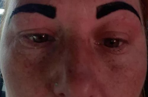 Kosmetoloq qadının qaşlarını bu hala saldı - 