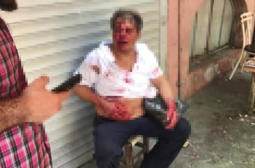 10yaşlı oğlana təcavüz etdiyinə görə görün hansı vəziyyətə saldılar - DƏHŞƏTLİ FOTO