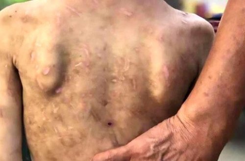 Nənənin nəvəsinə qarşı DƏHŞƏTLİ ƏMƏLİ - Ətini kəlbətinlə qopardı + VİDEO