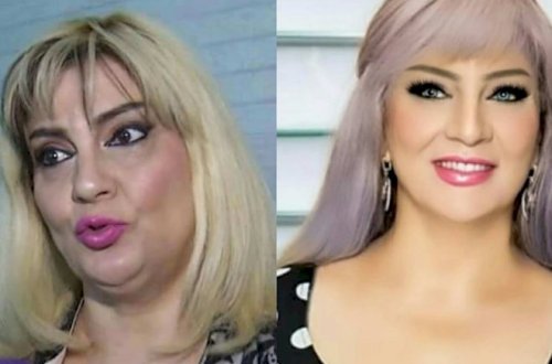 Nüşabə Ələsgərli fotoşopun “ağını çıxardı” - Fotolar