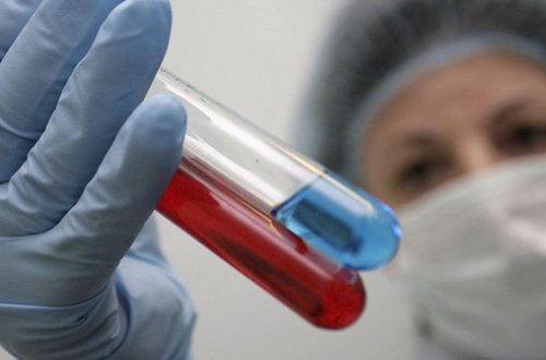 В США обнаружен редкий смертельный вирус