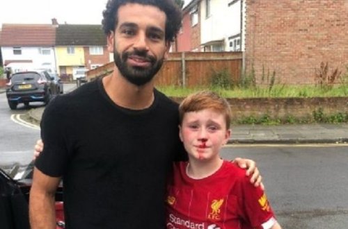 Разбитый нос за фото: еще один красивый поступок от Салаха – ФОТО