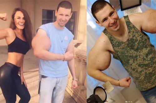 Əzələlərini iynə ilə şişirdənin qolları kəsilə bilər – Foto