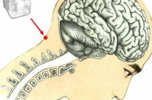 Boyundakı bu çökəyə buz qoyun, 10 yaş cavanlaşın