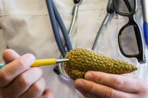 Mədəaltı vəzi xərçənginin 10 ilkin əlaməti - Azərbaycanda da geniş yayılıb