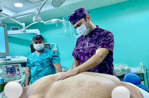 Bakıda 256 kiloqramlıq qadının üzərində inanılmaz əməliyyat olunub – Foto