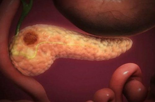 Hansı dərmanlar mədəaltı vəzin 