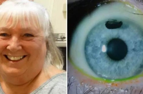 Татуировки на глазах заменили британке очки