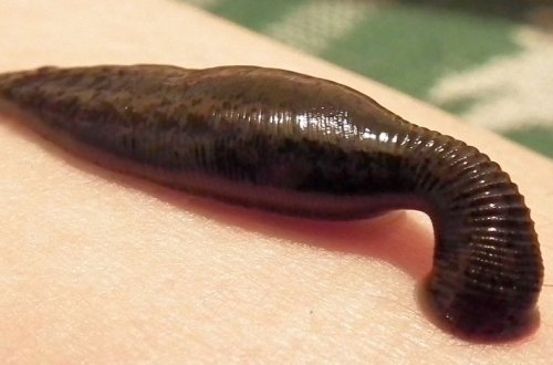 Мальчик с пиявкой в горле десять дней кашлял кровью и выжил