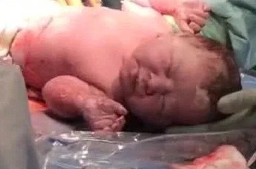 Uşaq anasının bətnindən çıxan kimi yatdı - Doğum evində maraqlı görüntülər - FOTOLAR