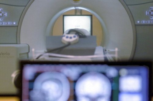 Искусственный мозг впервые подумал