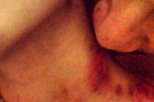 Ər arvadını dişləyərək öldürdü - FOTO