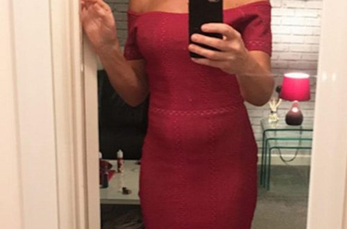 Sinə və piyçəkmə əməliyyatına 8000 manat ödəyən qadın eybəcər hala düşdü - FOTO