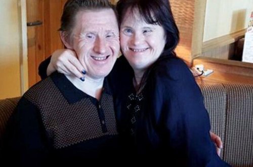 Dünyanın ilk Daun sindromlu evli cütlüyü - Gündə 100 dəfə 