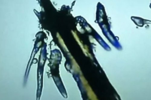 Çinli qadın kipriklərində minlərlə gənə yetişdirdi