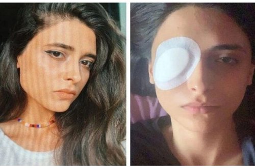 Bakıda lazer epilyasiyasında qızın gözünü zədələdilər – Kor olacaqdı – FOTO