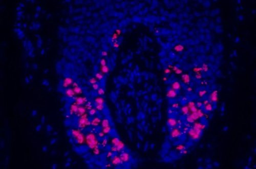 Создан безопасный для волос способ лечения рака