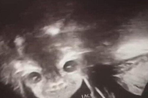 Uşağın cinsiyyətini öyrənmək üçün həkimə gedən ana həyatının şokunu yaşadı...