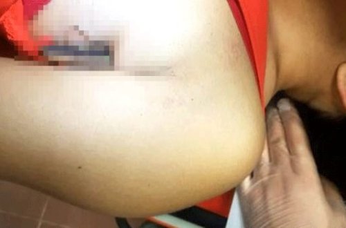 Avtomobil qəzası keçirən qızın başına gələnlər ŞOK ETDİ - FOTOLAR