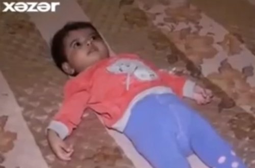 Peyvənddən sonra uşaq bu hala düşdü - VİDEO