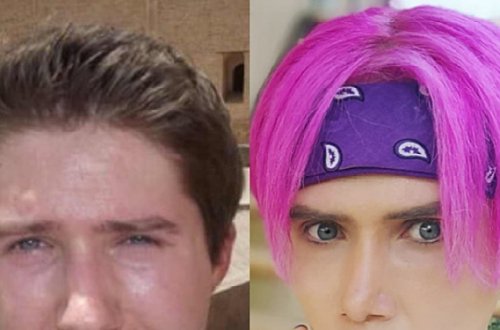 Müğənniyə oxşamaq üçün 15 dəfə əməliyyat olundu - Fotolar