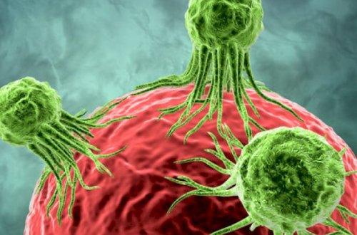 Diqqət: Bunu etməyin, xərçəng yaradır - Foto