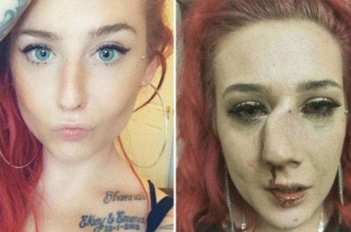 Qəzəbli kişi finalçı gözəli eybəcər hala saldı