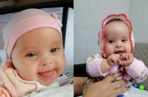 Как получить пенсию на ребенка с синдромом Дауна? Мучения матери 7-месячной дочери на примере Лалы Аслановой