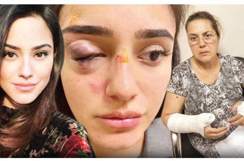 İş adamı hamilə sevgilisini küçədə döyüb bu günə qoydu - FOTO