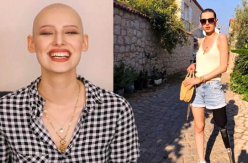 3 dəfə xərçəngə qalib gələn Neslihan vəfat etdi - FOTOLAR