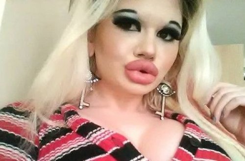 Студентка намерена сделать себе самые большие губы в мире - ФОТО