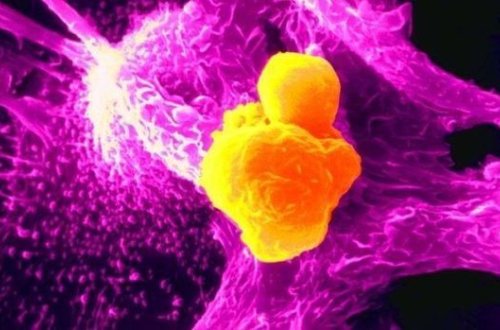 Xərçəngin müalicəsində inqilabi - YENİLİK