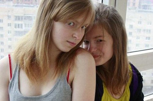 Qız bacısının qəşəngliyini qısqanıb, qulaqlarını kəsdi - FOTO